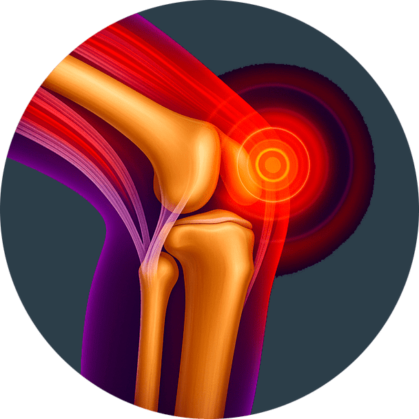 Inflammation articulaire